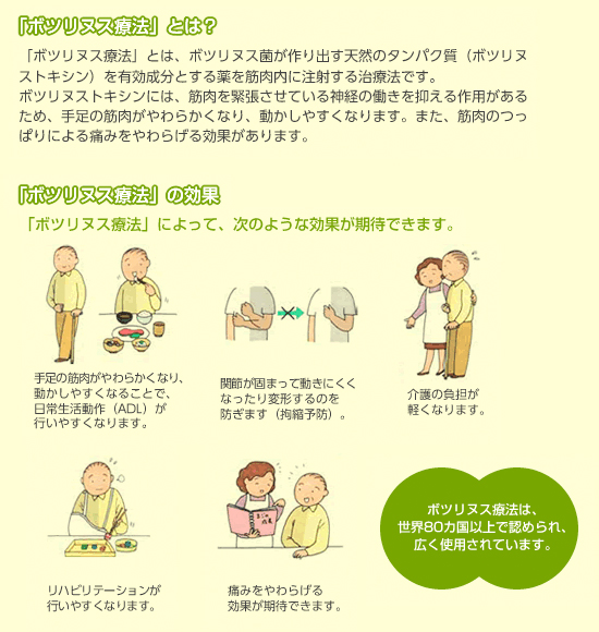 ボツリヌス療法